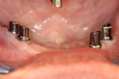 Abb13b