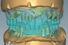 Abb9a