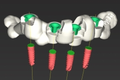 3D B14