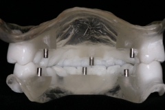 3D-B8