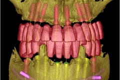 3D-B9