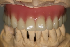 Allon-B13 Allon-B13
