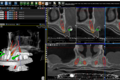 Allon-B4 Allon-B4