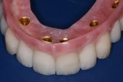 B9